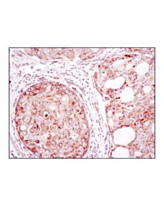 Cell Signaling Yb1 (D2b12) Rabbit mAb