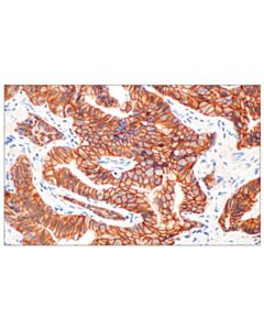 Cell Signaling Beta-Catenin (D10a8) Xp Rabbit mAb