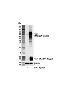 Cell Signaling TAK1 (F2R2G) Rabbit mAb