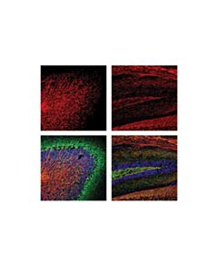Cell Signaling Myelin Basic Protein (D8x4q) Xp Rabbit mAb (Alexa Fluor 555 Conjugate)