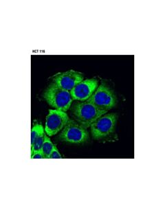 Cell Signaling Usp10 (D7a5) Rabbit mAb
