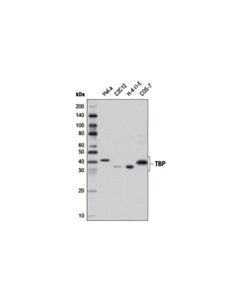 Cell Signaling Tbp Antibody