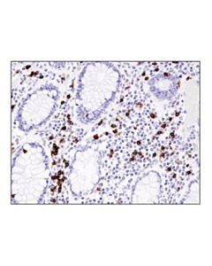 Cell Signaling Cd8alpha (D8a8y) Rabbit mAb