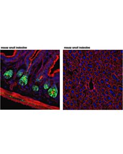 Cell Signaling Nkcc1 (D2o8r) Xp Rabbit mAb (Rodent Specific; If Specific)