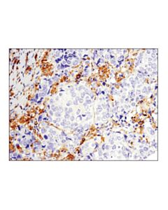 Cell Signaling Btk (D3h5) Rabbit mAb