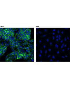 Cell Signaling Fgf Receptor 4 (D3b12) Xp Rabbit mAb