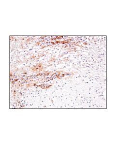 Cell Signaling Il-13ra2/Cd213a2 (E7u7b) Rabbit mAb