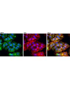 Cell Signaling Mypt1 (D6c1) Rabbit mAb
