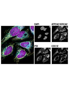 Cell Signaling Calcium Ion Regulation Antibody Sampler Kit