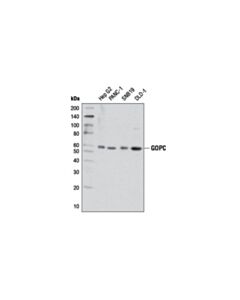Cell Signaling Gopc (D10a12) Rabbit mAb