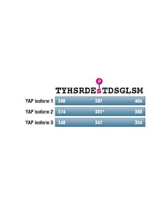 Cell Signaling Hippo Signaling Antibody Sampler Kit