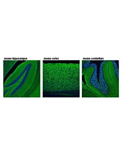 Cell Signaling Synapsin-2 (D6s9c) Rabbit mAb