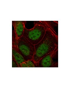 Cell Signaling Tcf1/Tcf7 (C63d9) Rabbit mAb (BSA And Azide Free)