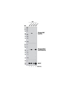 Cell Signaling Phospho-Akt2 (Ser474) (D3h2) Rabbit mAb (Akt2 Specific)