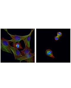 Cell Signaling Beta-Tubulin (D3u1w) Mouse mAb
