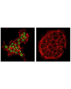 Cell Signaling P300 (D8z4e) Rabbit mAb