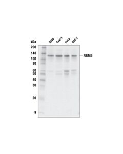 Cell Signaling RBM5 (E8G8K) Rabbit mAb 20 uL