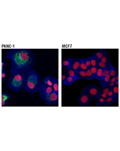 Cell Signaling Ctgf (D8z8u) Rabbit mAb