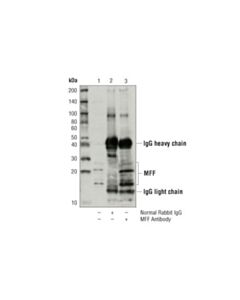 Cell Signaling Mff Antibody