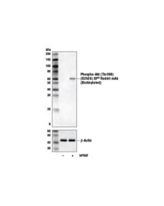 Cell Signaling Phospho-Akt (Thr308) (D25e6) Xp Rabbit mAb (Biotinylated)