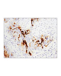 Cell Signaling Cd133 (D4w4n) Xp Rabbit mAb