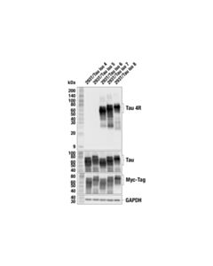 Cell Signaling Tau 4R (F4O1Y) Mouse mAb 20 uL