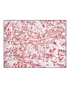 Cell Signaling P38 Mapk (D13e1) Xp Rabbit mAb