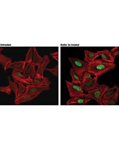 Cell Signaling Mdm2 (D1v2z) Rabbit mAb