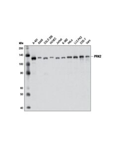 Cell Signaling Prk2 (D10a10) Rabbit mAb