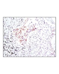Cell Signaling Phospho-Mob1 (Thr35) (D2f10) Rabbit mAb