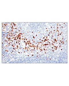 Cell Signaling Ly-6g (E6z1t) Rabbit mAb
