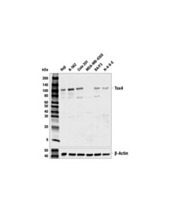 Cell Signaling Tox4 (E9U3L) Rabbit mAb 20 uL