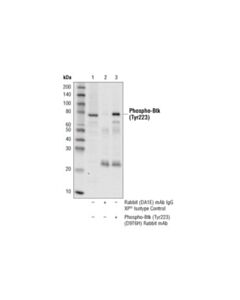 Cell Signaling Phospho-Btk (Tyr223) (D9t6h) Rabbit mAb