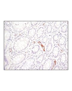 Cell Signaling Sparc (D10f10) Rabbit mAb