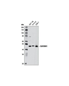 Cell Signaling Suv39h1 (D11b6) Rabbit mAb