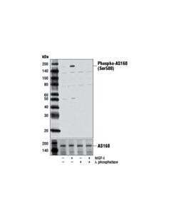 Cell Signaling Phospho-As160 (Ser588) (D8e4) Rabbit mAb