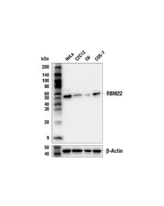 Cell Signaling RBM22 (E9E6Z) Rabbit mAb