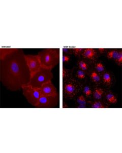 Cell Signaling Egf Receptor (D38b1) Xp<LT/>Sup&Gt;®<LT/>/Sup&Gt; Rabbit mAb (Alexa Fluor<LT/>Sup&Gt;®<LT/>/Sup&Gt; 594 Conjugate)
