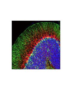 Cell Signaling Neurofilament-L (C28e10) Rabbit mAb (Alexa Fluor 594 Conjugate)
