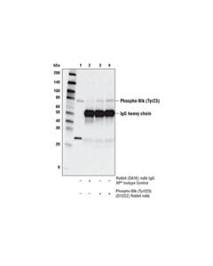 Cell Signaling Phospho-Btk (Tyr223) (D1d2z) Rabbit mAb