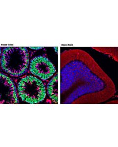 Cell Signaling Ddx4 (D10c5) Rabbit mAb