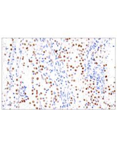 Cell Signaling Hif-1alpha (E1v6a) Rabbit mAb (Bsa And Azide Free)