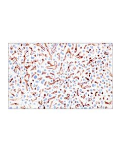 Cell Signaling Cd206/Mrc1 (E6t5j) Xp® Rabbit mAb (BSA And Azide Free)