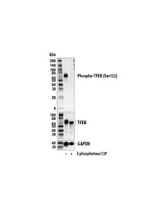 Cell Signaling Phospho-Tfeb (Ser122) (E9m5m) Rabbit mAb