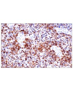 Cell Signaling Cd23 (E1r4g) Rabbit mAb