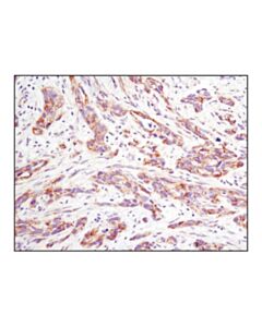 Cell Signaling Non-Phospho (Active) Beta-Catenin (Ser33/37/Thr41) (D13a1) Rabbit mAb