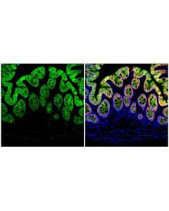 Cell Signaling Beta-Catenin (D10a8) Rabbit mAbjugate)