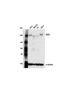 Cell Signaling REST (E3L2I) Rabbit mAb 20 uL