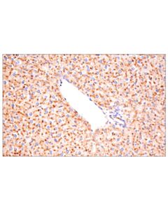 Cell Signaling Cathepsin D (E7z4l) Xp Rabbit mAb