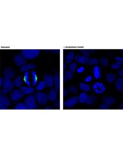 Cell Signaling Phospho-Tacc3 (Ser558) (D8h10) Xp Rabbit mAb